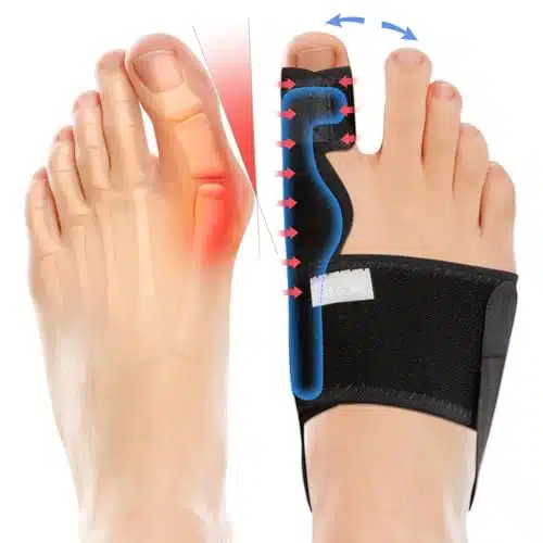 Fitgeno Bunion Corrector Women & Men Big Toe Foot Straightener Splint Brace   Adjustable Bunyan Correction Orthopedic for Hallux Valgus Pain Relief Pcs