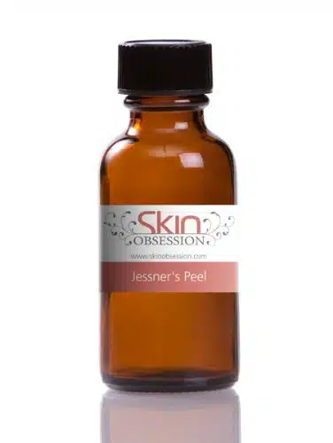 Skin Obsession JESSNER'S at HOME Chemical Peel (oz bottle) Helps Treat Acne Scars, Pimples, fine lines